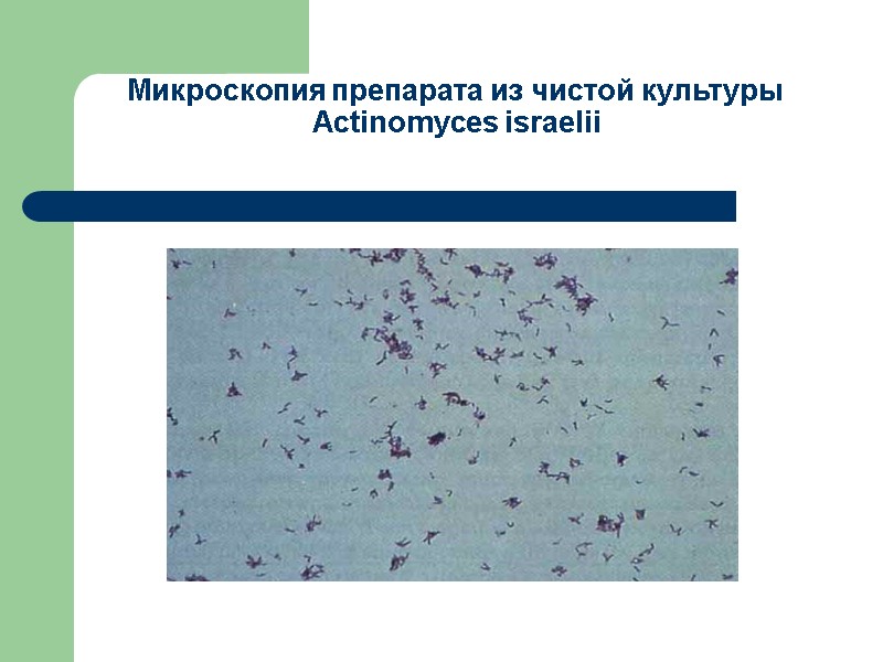 Микроскопия препарата из чистой культуры Аctinomyces israelii